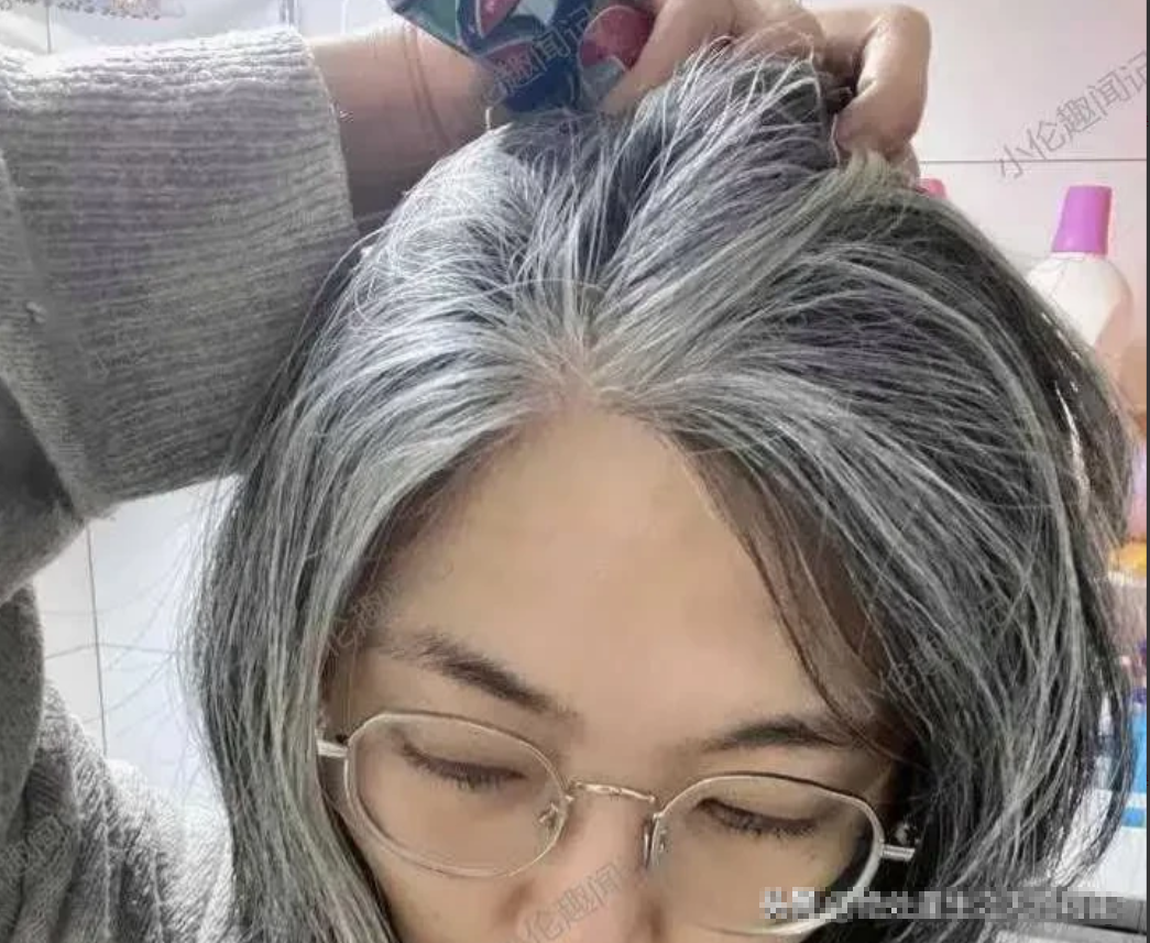 湖北武汉，27岁女孩因炒股爆亏19万，头发一夜白了头
股市有风险，投资需谨慎，对