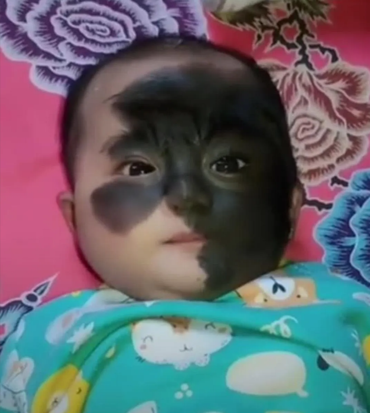 检查没有问题，但是宝宝就这样出生了。 妈妈心疼得哭了！ 可怜的小宝贝！ 请问能治
