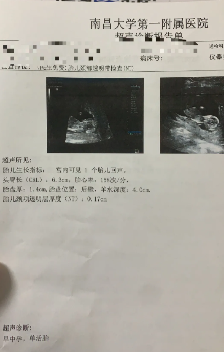 时隔11年的意外，发现时已经12周了，已经和老公孩子们商量好了，决定要了
老公弱