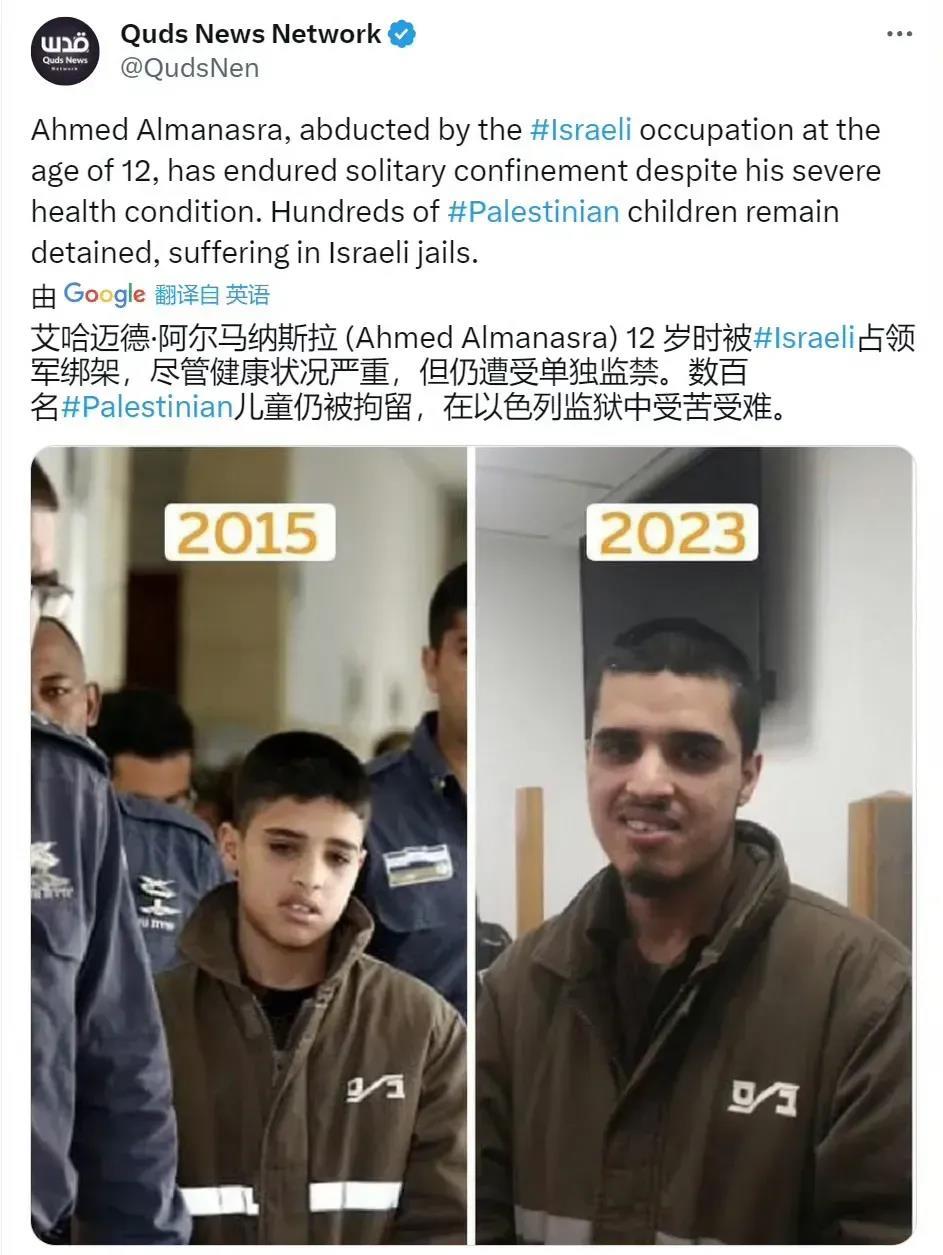 这个巴勒斯坦少年的经历向世人表明，以色列对加沙地区的镇压是不区分年龄的。
巴勒斯