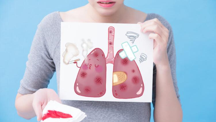 为啥中国越来越多人得肺癌？医生坦言：除了抽烟外，还有5大诱因