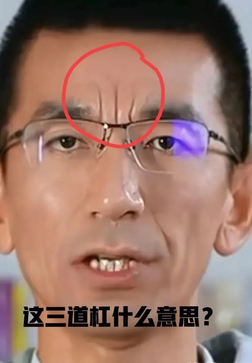 相由心生！
万能的网友知道东方甄选CEO孙东旭眉间的三道竖杠是什么意思？
东方小
