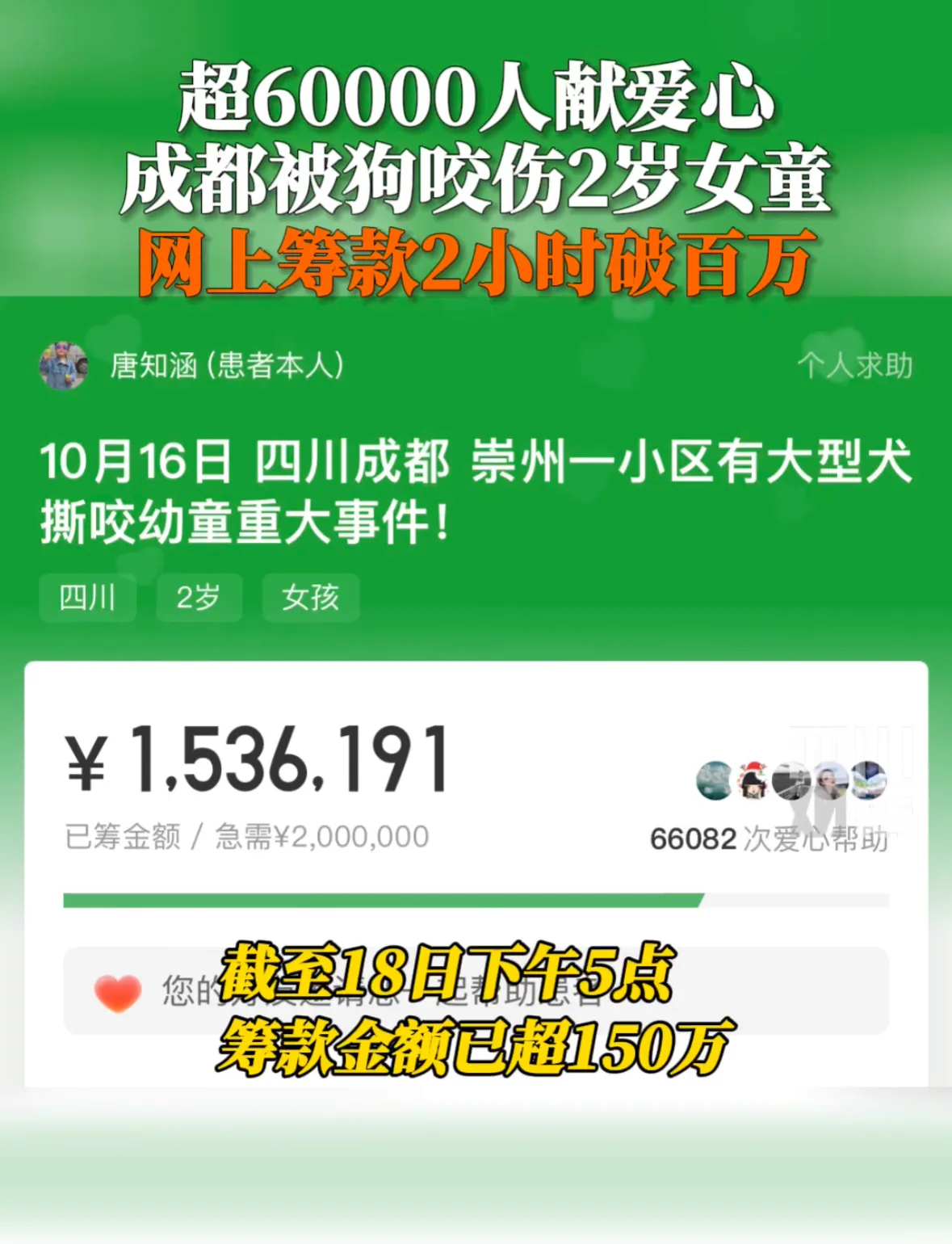 10月18日，成都被狗咬伤女童网上筹款2小时破100万元。目前女童仍在华西医院I