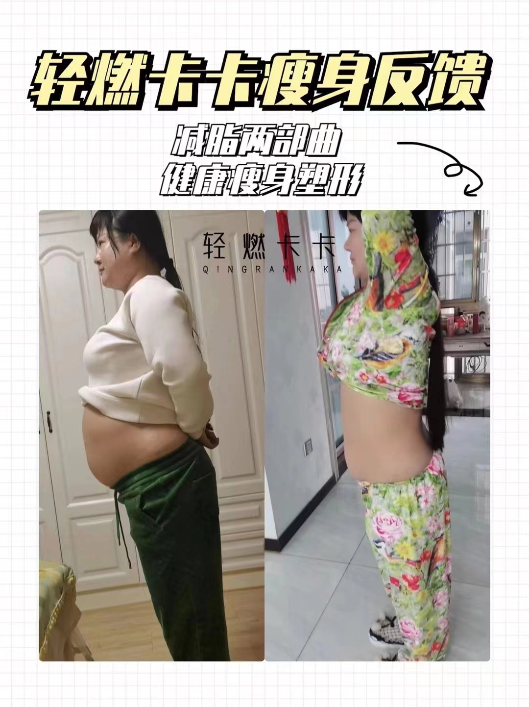 久坐‮公办‬室，极度缺乏‮动运‬，加大了肥胖的几率‮导，‬致腿粗肚子‮屁大‬股厚