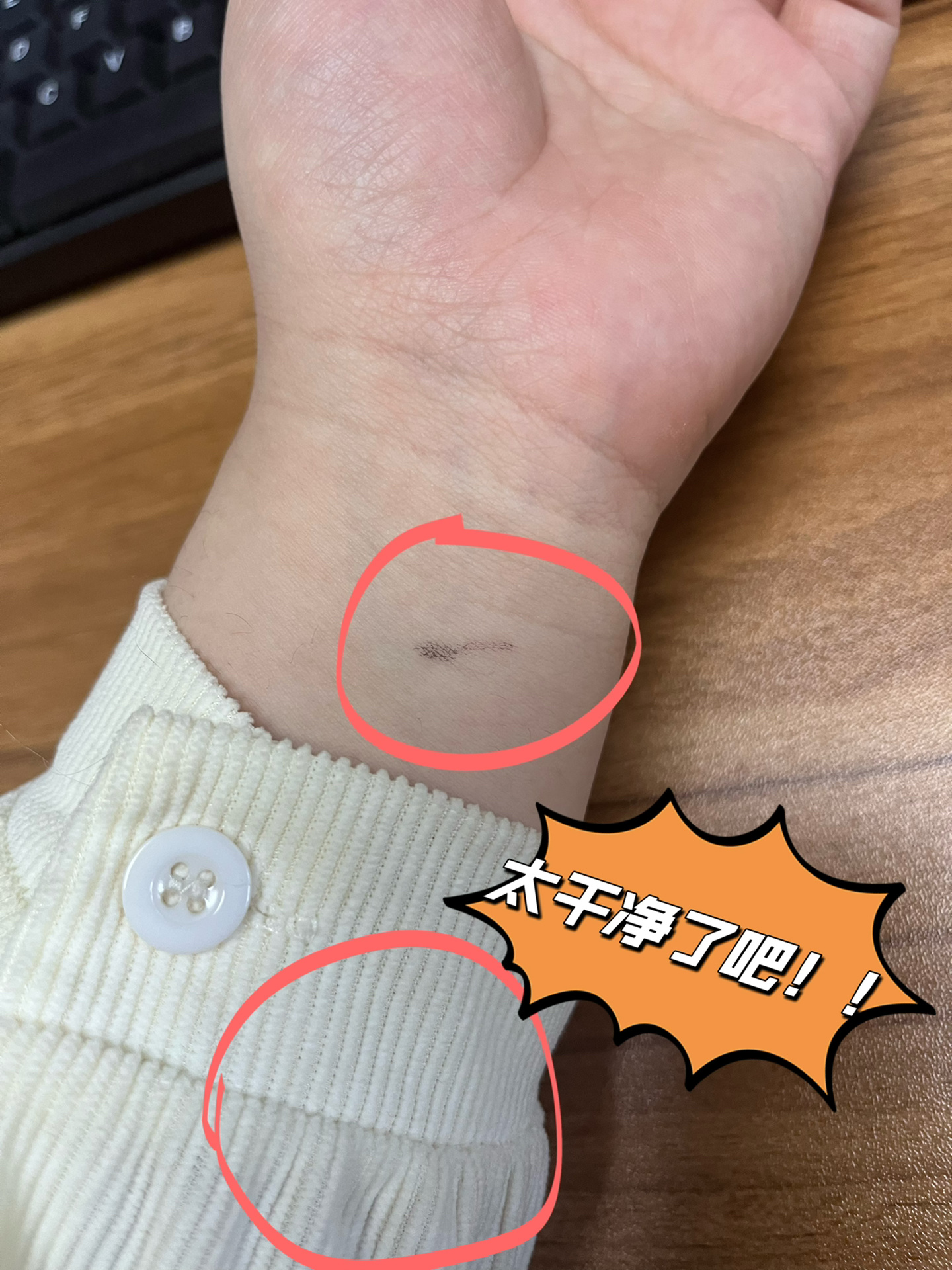 洗掉水笔#怎样能洗掉白衬衣上的黑色水笔#