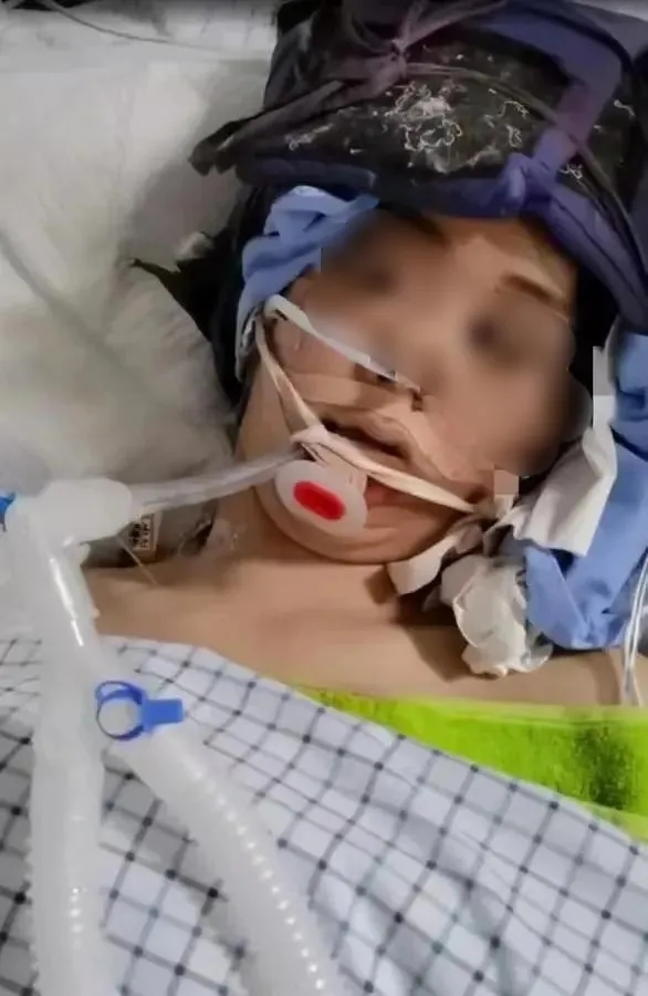 安徽淮南，男子李峰长期家暴，因怀疑妻子出轨，对准妻子头部猛击数拳，致使黄雅心跳骤