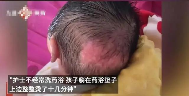 整整烫了十几分钟！出生4天的新生儿被护士烫伤头部……涉事医院回应
11月2日，河