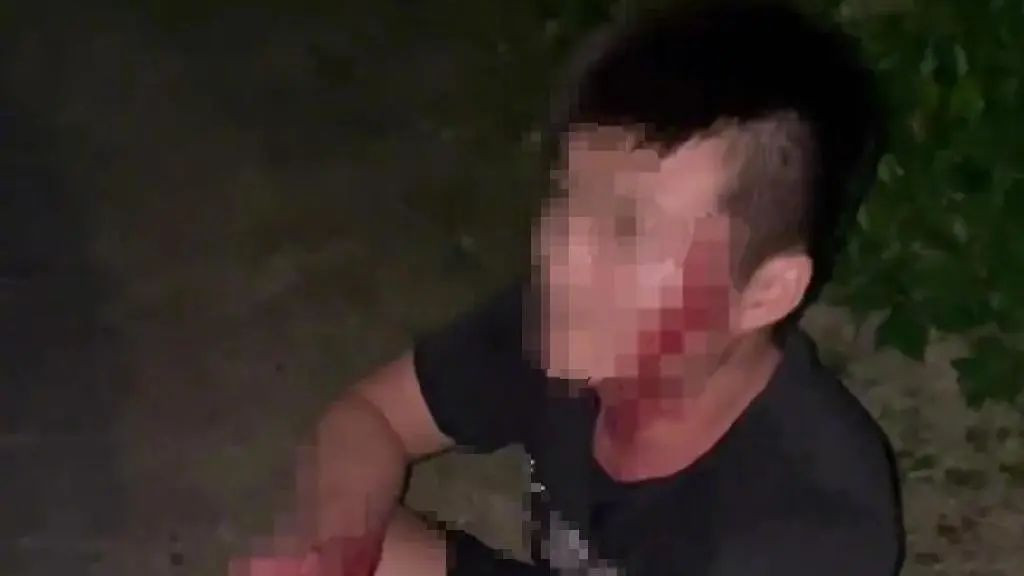 3醉酒男子威吓女子反被砍伤，声称只是开玩笑，女子已被警方带走