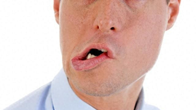 风中狂奔之后，发现自己无法闭眼，讲话漏风、口角流涎，怎么回事