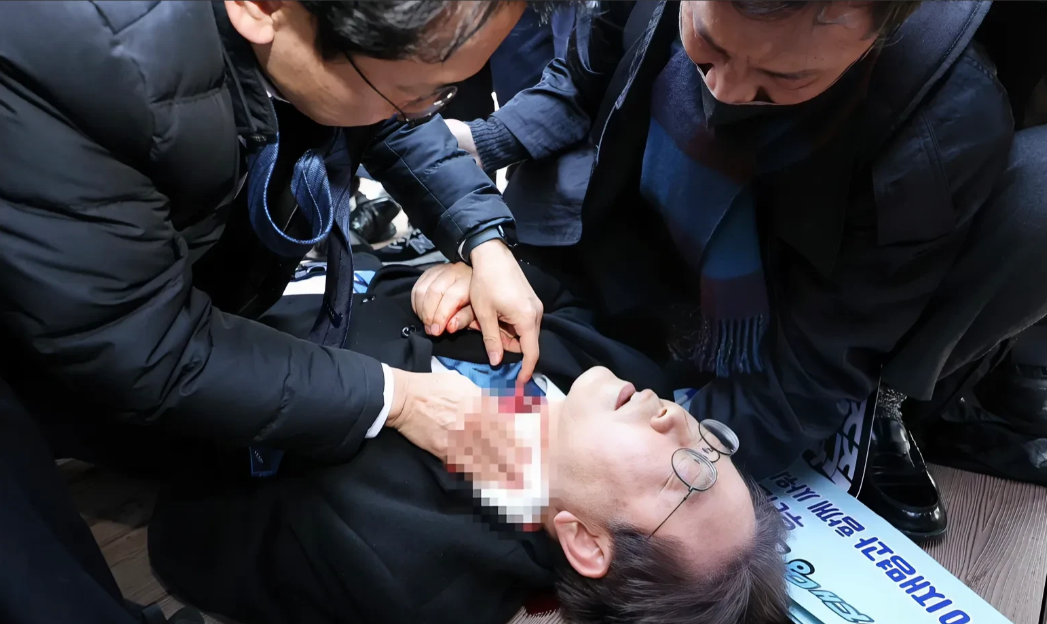 太幸运了！李在明已无大碍，支持率或将飙升。韩国最大在野党党首李在明遇刺后，被曝已