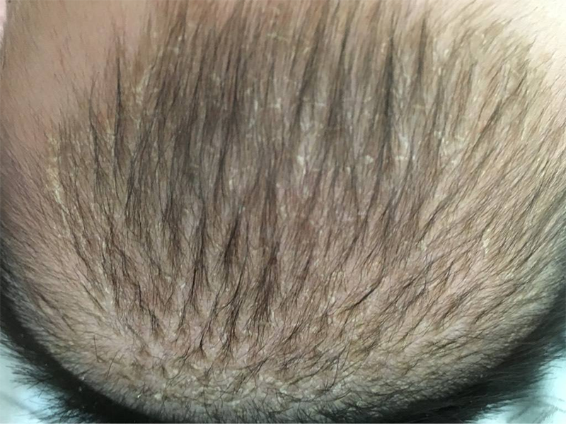 #宝妈育儿交流#  在我们的想象之中，小宝宝都应该是干干净净、白白嫩嫩的，然而事