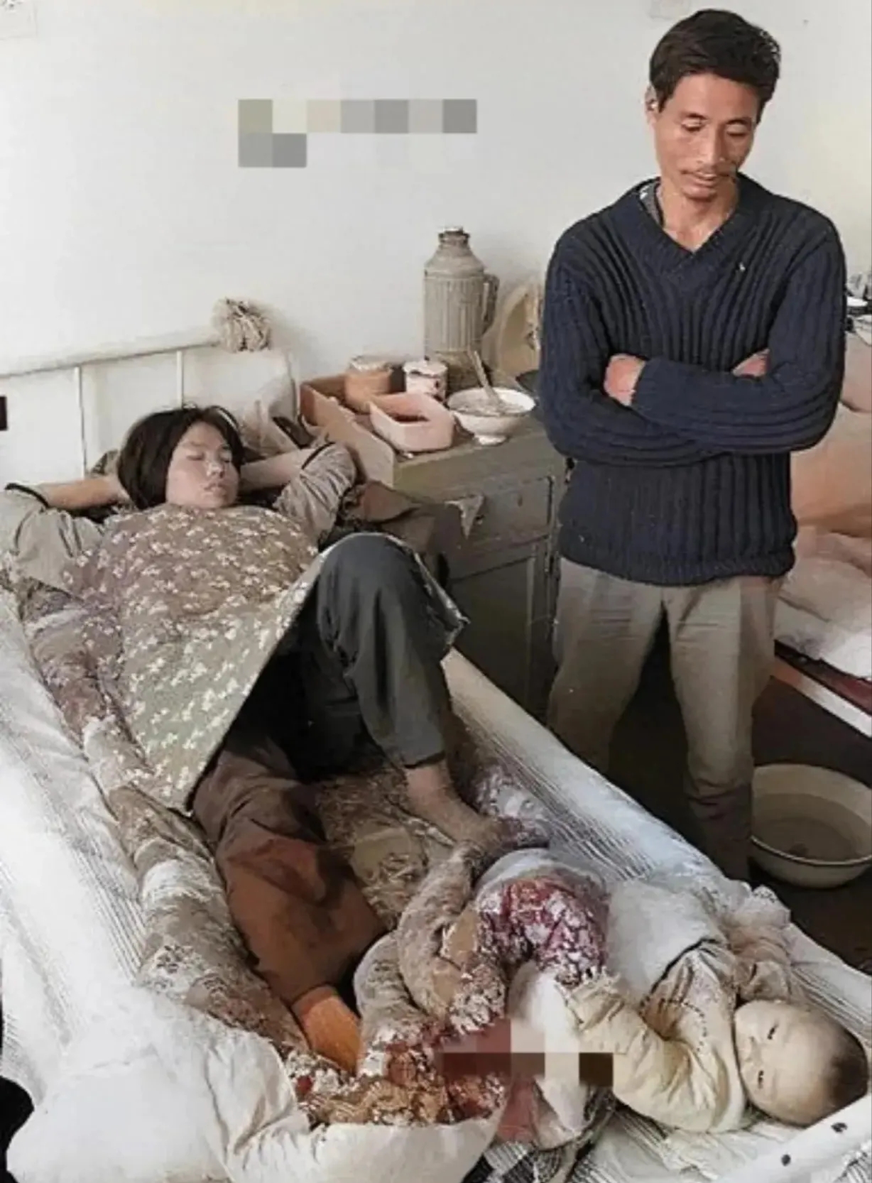 这张照片拍摄于1992年，陕西临潼的一家医院里，刚刚做完“结扎”手术的妇女躺在病