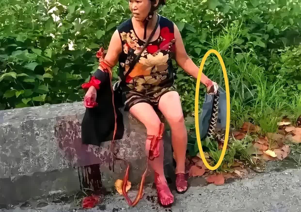 广西百色大妈被大蛇咬伤，紧急自救。大妈不慌不忙地打死蛇，紧紧绑住伤口，等待救援。