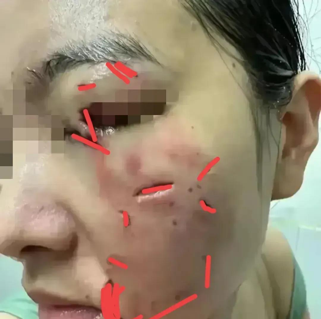 松狮犬咬人事件后，女子起诉狗主人，索要800万赔偿，而起初表示该怎么赔就怎么赔的