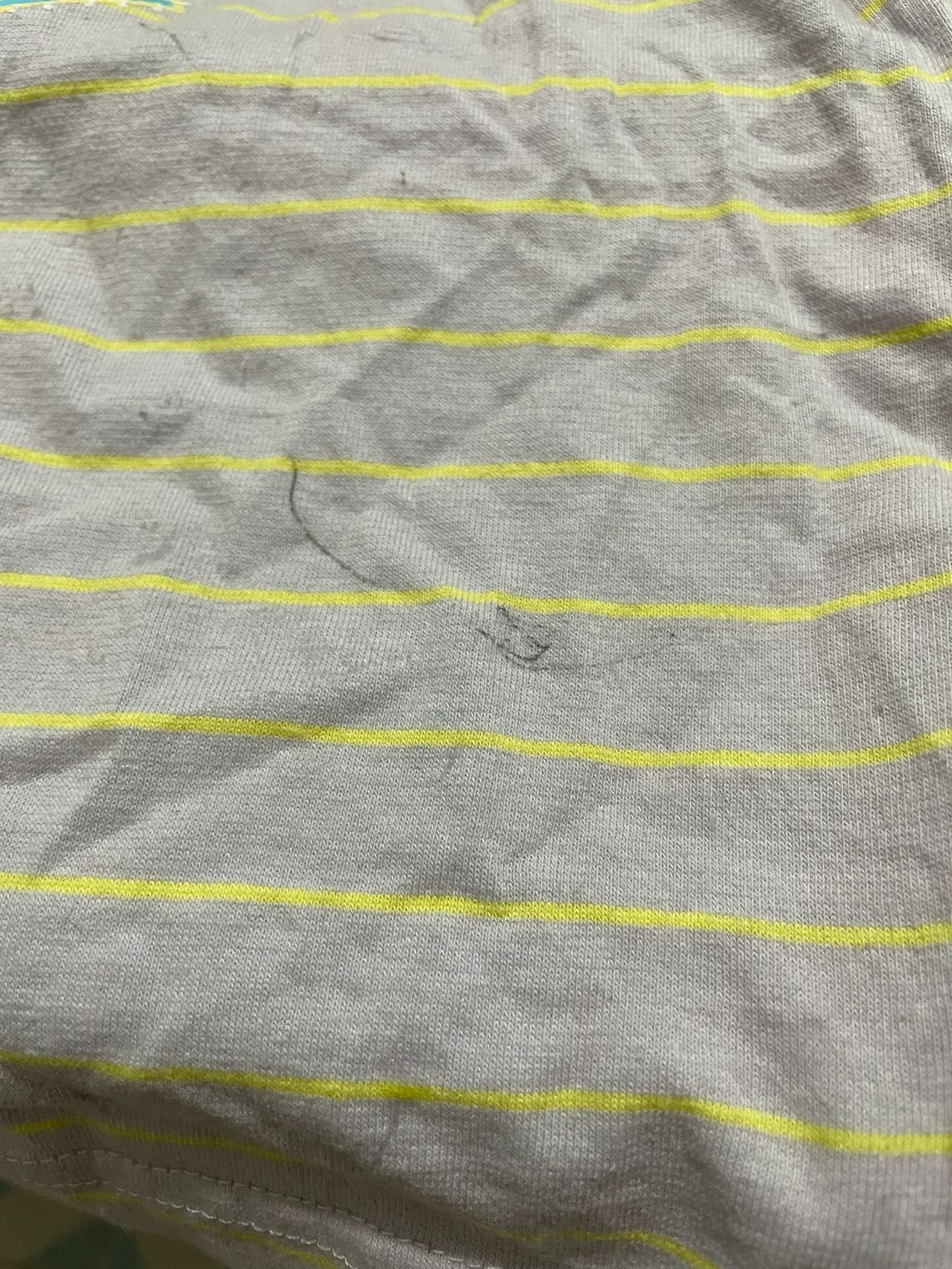 处理笔渍#怎样能洗掉白衬衣上的黑色水笔#