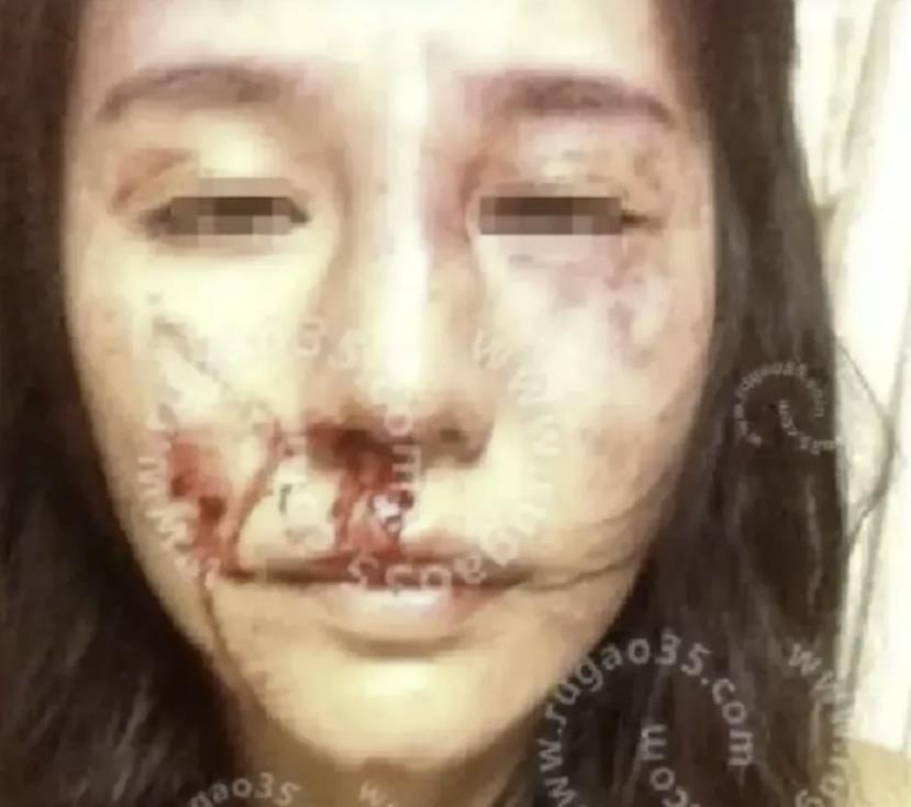 “山东德州，妻子胆大包天，丈夫在二楼睡觉，她在一楼与情人私会，遭到丈夫发现随手抄