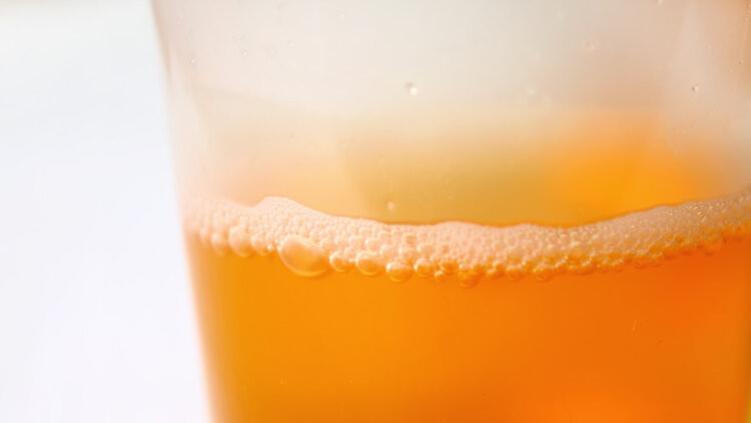 不是皮肤病而是肾病信号？提醒：3种皮肤异样，警惕肾衰竭来临