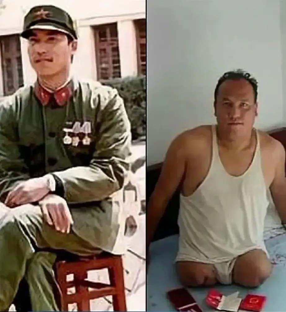 请不要吝啬您的双手，为老山英雄点赞！
他18岁参军，在国家召唤的时候，毅然决然的