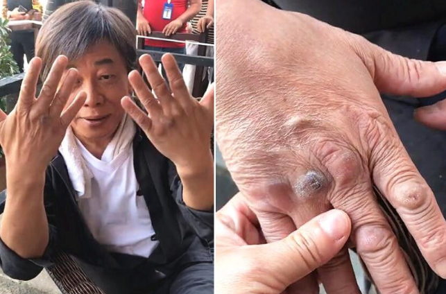 梁小龙被封杀原因曝光！2022年，他爆料说：“当年十个人追着我砍，我身中11刀，