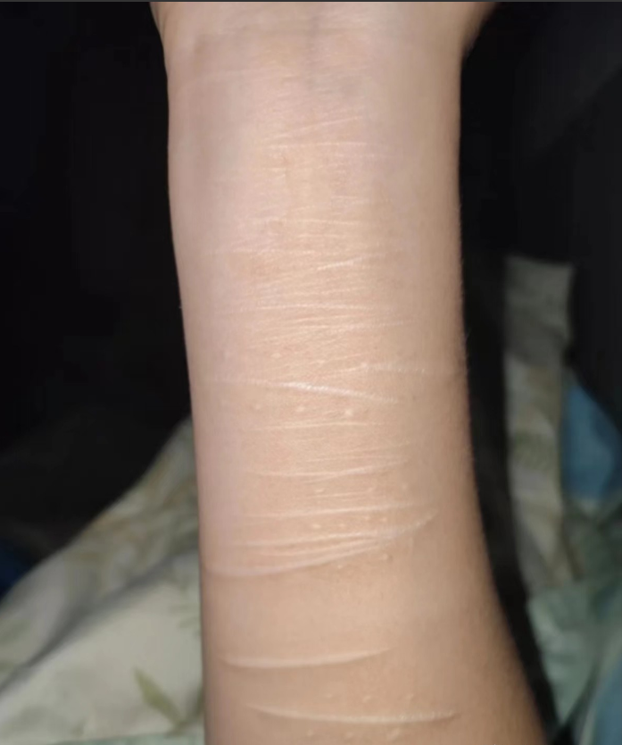 网恋就要奔现了，害怕男朋友嫌弃自己，这种情况用粉底液遮一遮怎么样呢？大家伙帮忙出