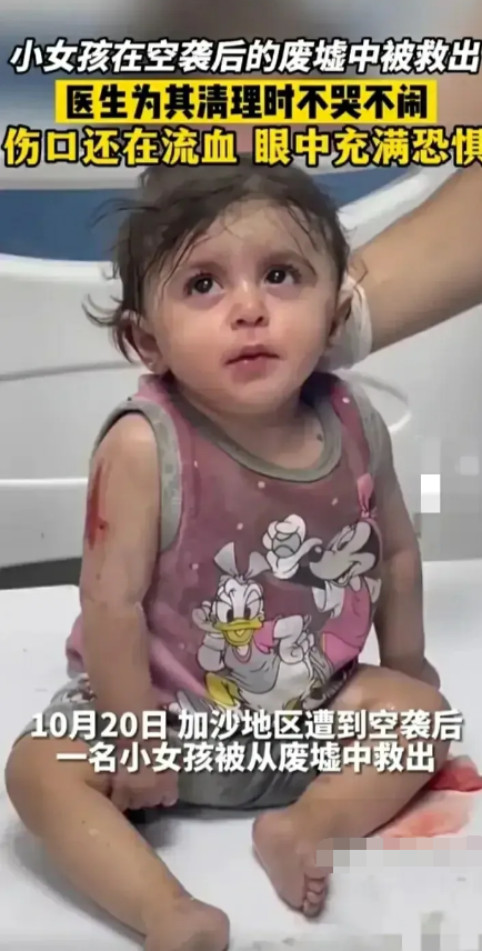 可怜的娃，据说这个可爱的小女孩已经离开了这个世界。昨天看到的时候，以为她只是受了