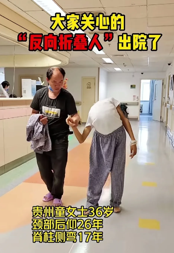 大家关心的“反向折叠人”出院了，看见她手术成功，我感觉喘气都顺畅了。这是北大医院