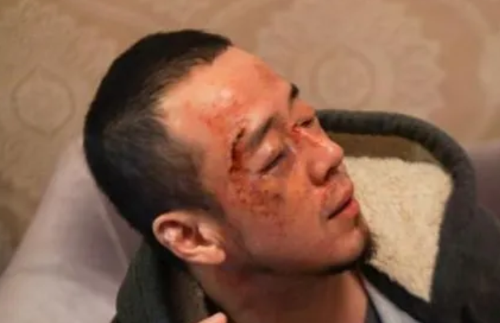 大瓜！歌手杨坤在长沙演出后被暴打，现场画面流出，好惨！

视频中有杨坤被打的照片