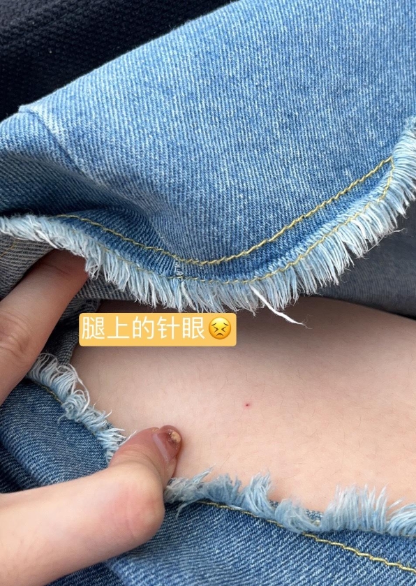 早上买早饭的时候

被一个提着黑色塑料袋的大妈撞了一下

当时大腿就很刺痛

以