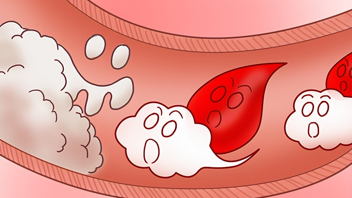 最大的病，还是痰瘀！教你两味药，化痰又化瘀，让你无病一身轻