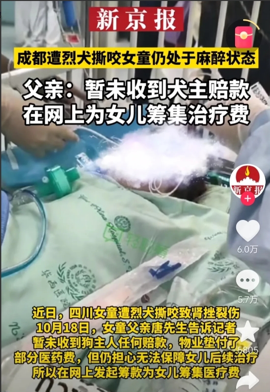 四川成都小女孩被黑狗咬伤，黑狗主人最高面临七年以下有期徒刑，10月16日，四川成
