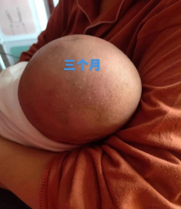 三个月，一个孩子一生的后脑勺就此定型了，这到底是故意为之，有其他说法，还是大人们