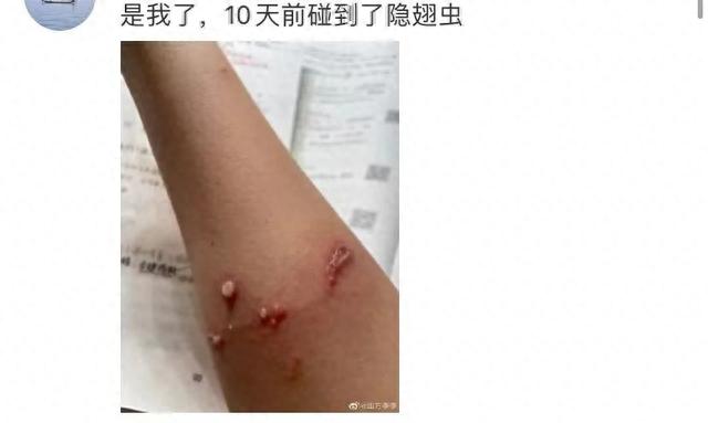 【河南多地发现神秘飞虫，被称为“飞行的硫酸”】

近日，河南多地的网友表示，自己