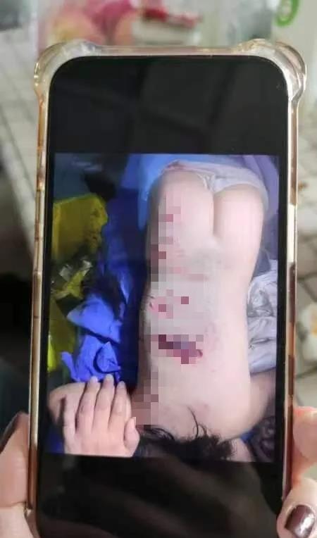 恶犬咬人，而人却不能吃狗肉，爱狗人士这时候集体失声？

四川崇州市的一名两岁女童