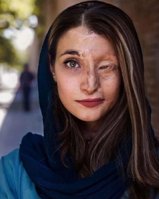 这不是一个选择，从来都不是

Marzieh Ebrahimi，因为不戴头巾而遭