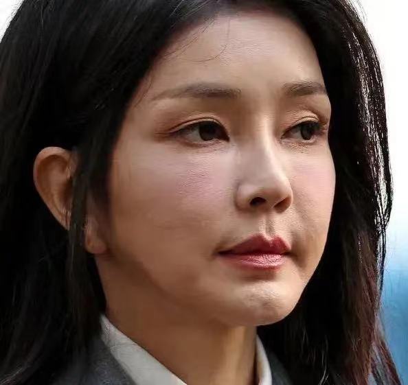 医美真的要慎重。韩国第一夫人金建希带给英国人一点小小的震撼！每日邮报不惯着她，直