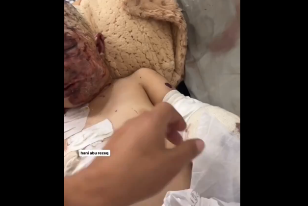 儿童奥马尔，他的家庭成员在努塞拉特难民营遭到占领军轰炸后全部遇难，他因伤势过重，