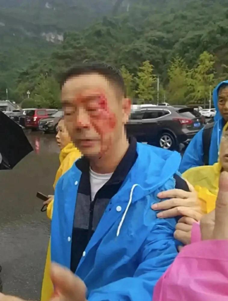 张家界多名身着警服保安殴打游客后续：事情大了，协警成了保安。
9月21日，来自四