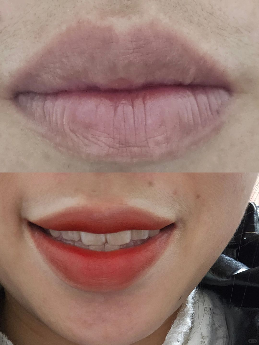 终于不再为自己的厚嘴唇👄自卑了
因为自己的嘴唇厚被别人嘲笑过
所以一直很自卑
