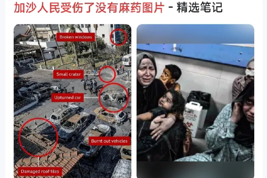 加沙人民都不知道疼了。
以色列轰炸加沙快一个月了，断水断电，断粮断药，加沙老百姓