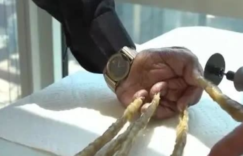 2018年，印度一老翁毅然剪掉留了66年，长达9.09米的左手指甲，没想到剪掉指