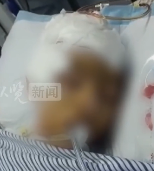 广东一中学生疑被3名学生打成植物人

从前觉得校园暴力是肉体上的霸凌 但今天当我