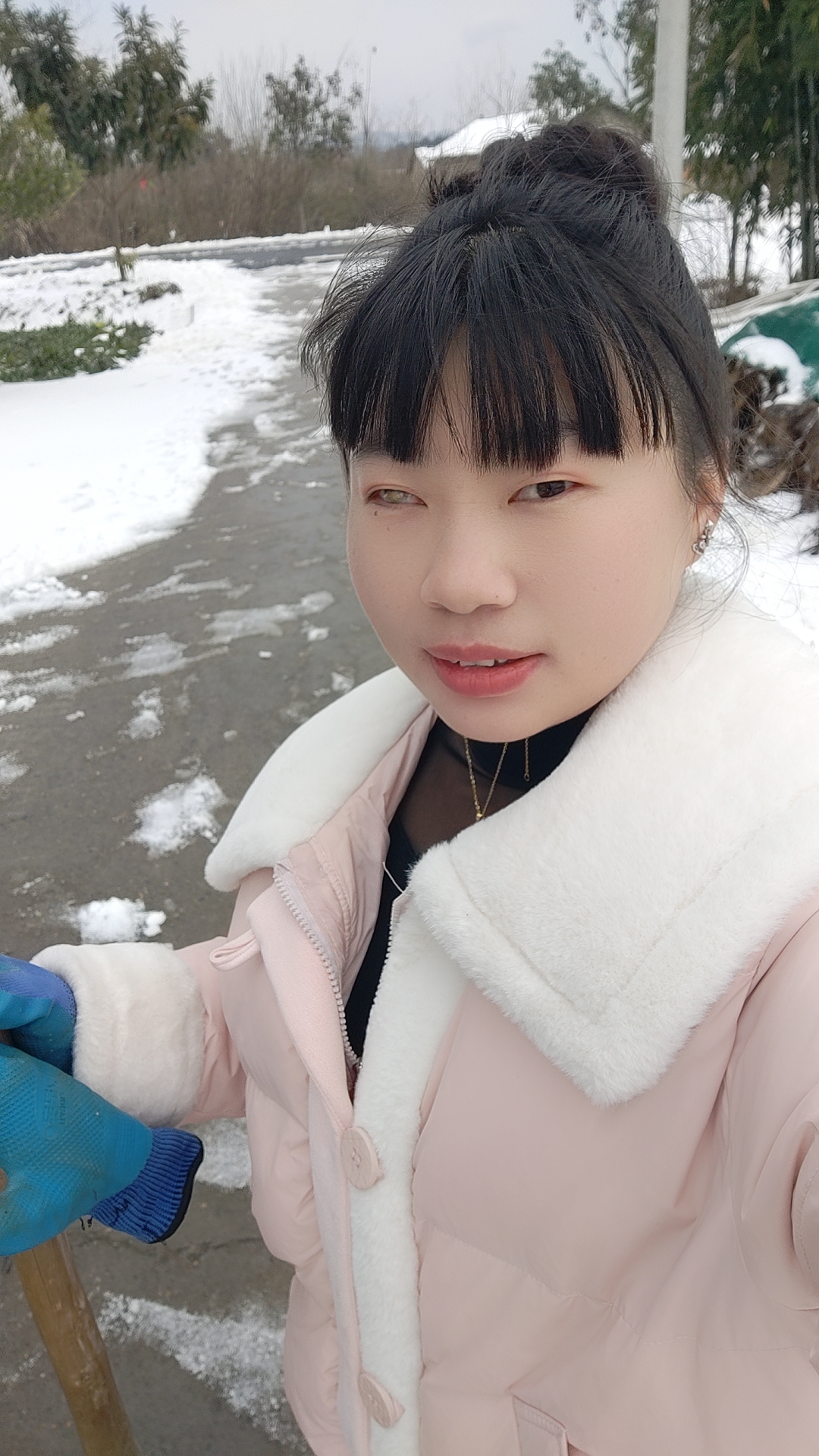 很多朋友问我眼睛怎么回事，我的眼睛是在我五六岁的时候被我堂姐用剪刀打瞎的，也就是