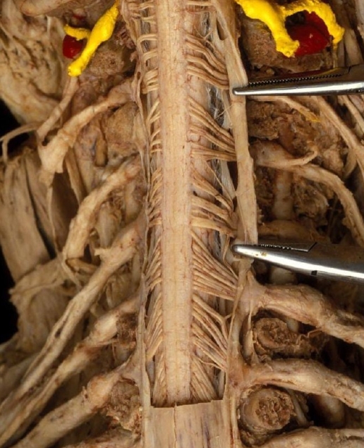 没有脑脊液的脊髓 ​​​