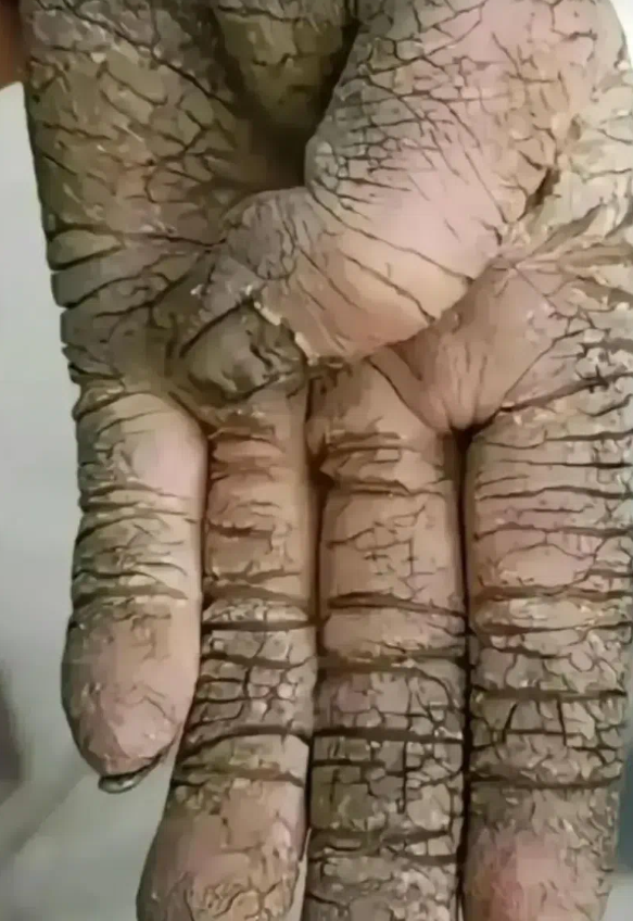 看到这双手的照片，让人不禁感慨万分。这张照片是我在参与农村义工活动时，为一位老农