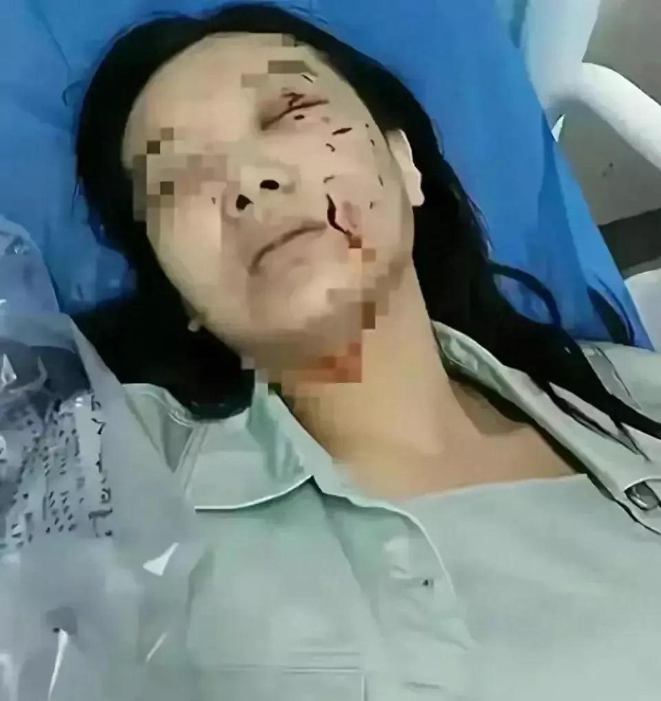 江苏松狮犬咬人后续来了：女子索赔800万被拒，主人怒杀当事狗

       江