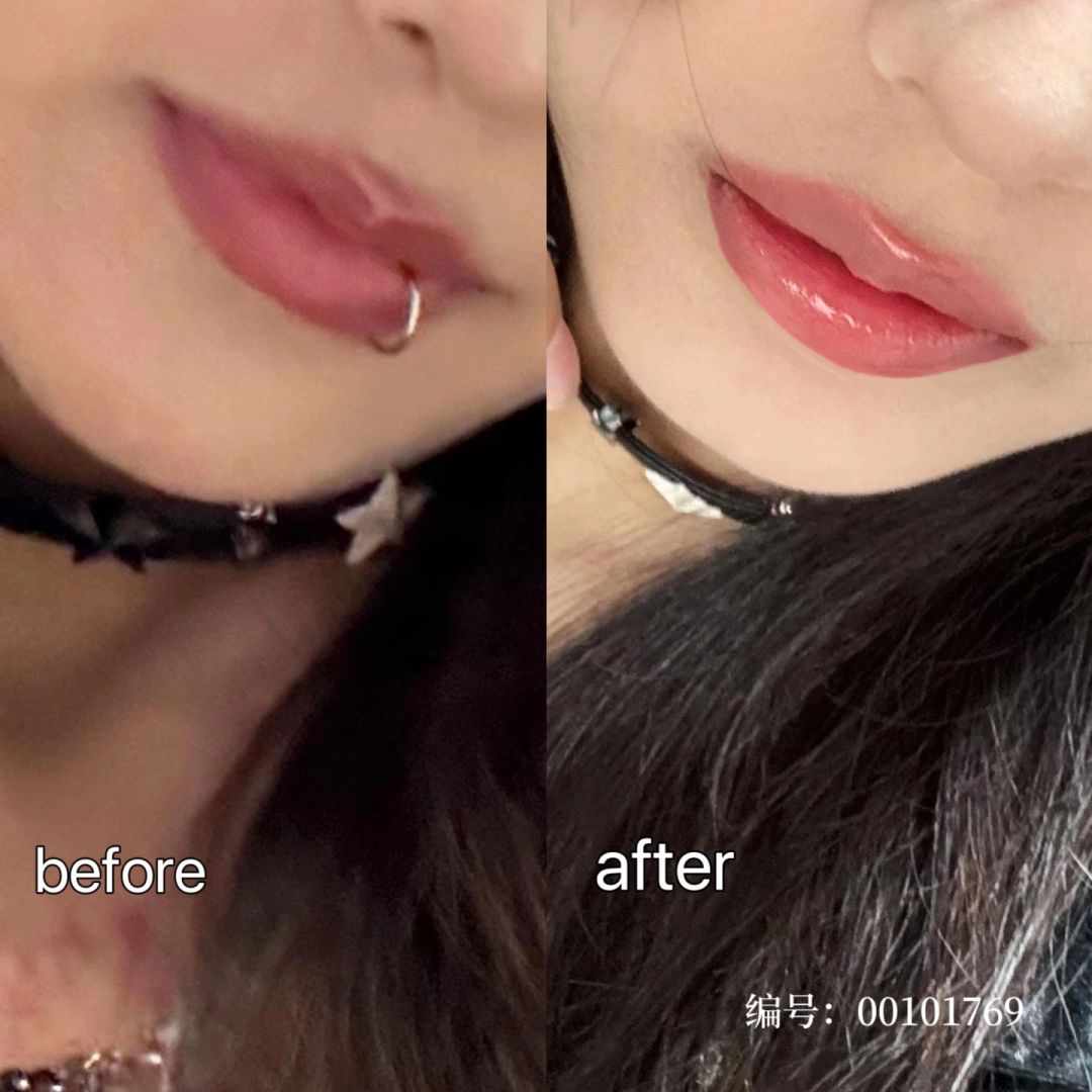 南京丰唇👄是你喜欢的唇型模板吗？
⏪“我do的嘴巴刚满一个月~
就忍不住给你们