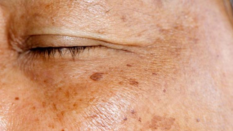 你的“福相”，可能是大病信号！面部出现5个“怪象”，尽早检查