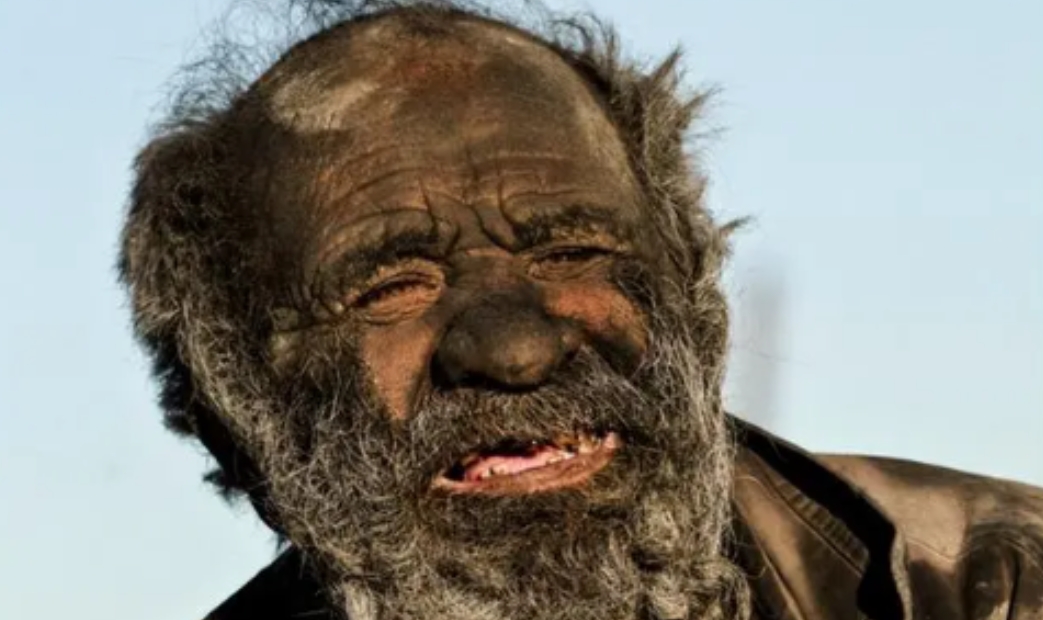 “你太脏了！”2022年，在好心人的劝说下，一位坚持了60年不洗澡的94岁伊朗老