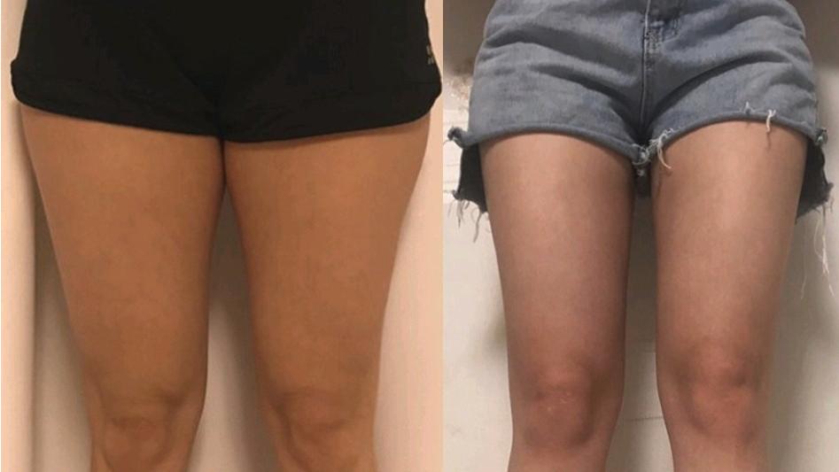 脂肪在慢慢消失，偷偷变瘦的10个征兆