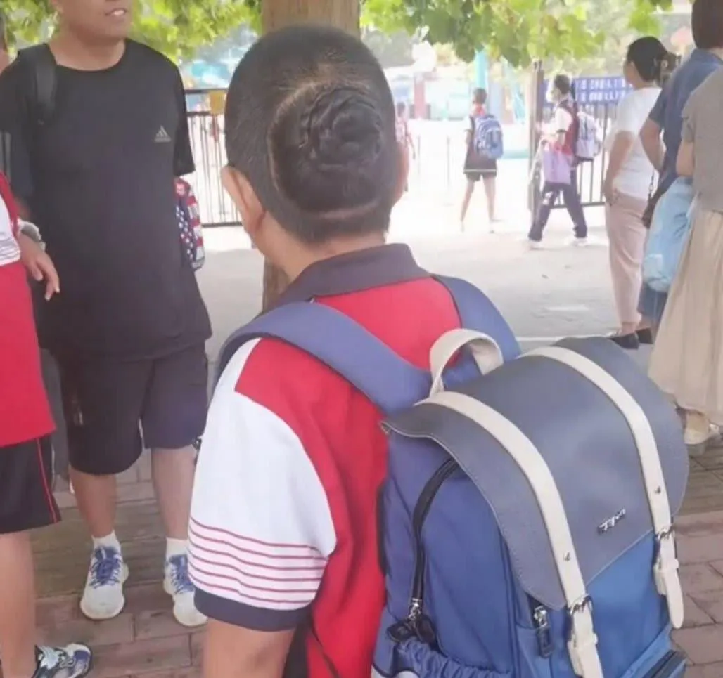 浙江一名9岁男孩从小就在后脑勺上长着头发。他的祖母不允许他剪掉它，称这叫长生，不